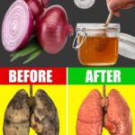 Limpia tus pulmones: el poderoso remedio de cebolla y miel