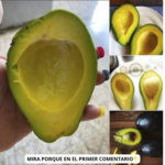 Descubre las Enfermedades que Evitas al Consumir Aguacate