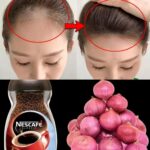 Descubre el Poder del Café y la Cebolla: Un Remedio Natural para la Caída del Cabello