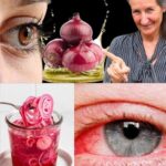 Mejora Tu Vista Naturalmente: Cómo la Cebolla Puede Ayudarte en 5 Días