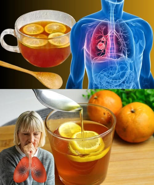 Jarabe casero para la tos y la gripe