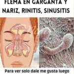 Remedios Caseros para Eliminar Mocos, Flema y Rinitis