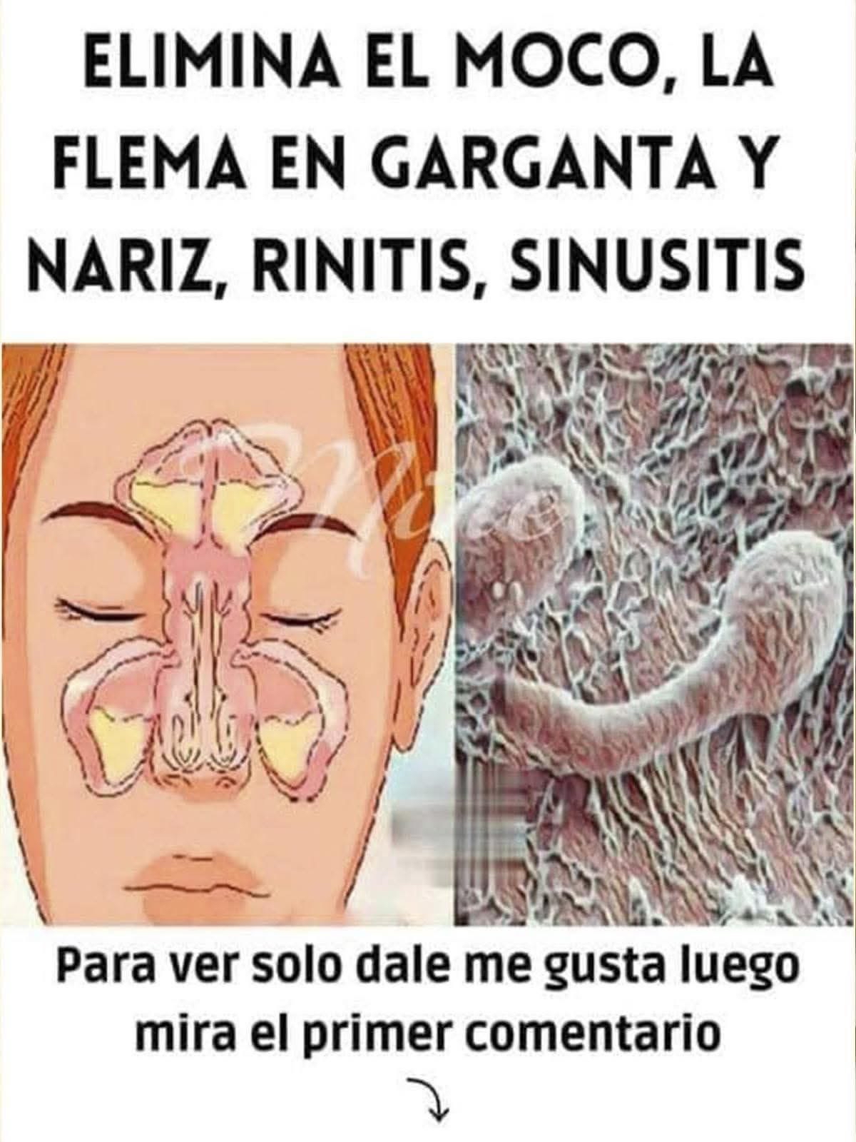 Sistema nasal con congestión