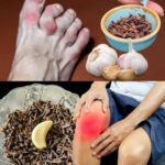 Receta Natural para Aliviar el Dolor de Piernas, Reumatismo y Artritis