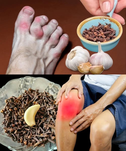 Remedios naturales para aliviar el dolor de piernas