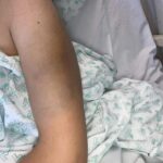 Consecuencias de Acostarse Con Salud Dañada: Cuidado y Remedios Naturales para la Recuperación