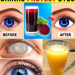 8 Bebidas Naturales que Previenen las Cataratas y el Glaucoma