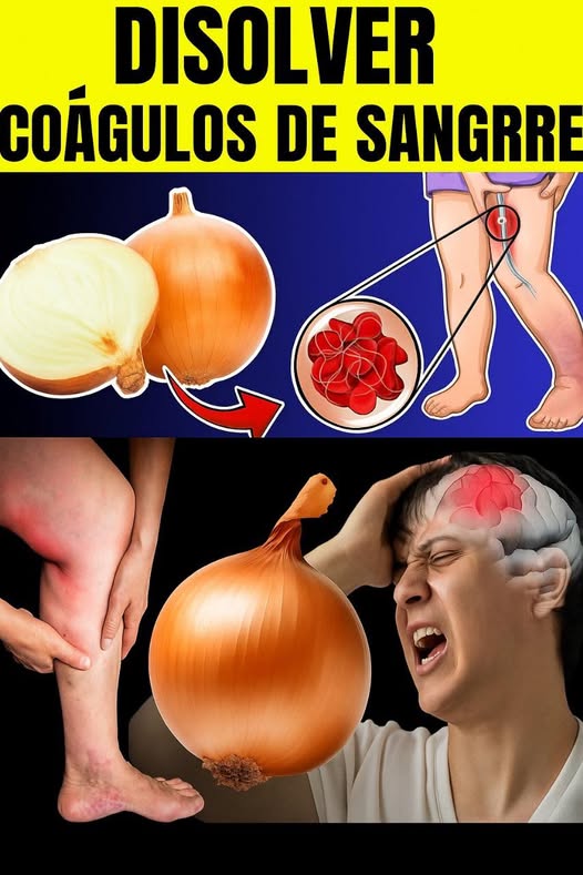 Alimentos que disuelven coágulos de sangre