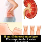 8 Señales de Advertencia de Que Tus Riñones Están en Peligro