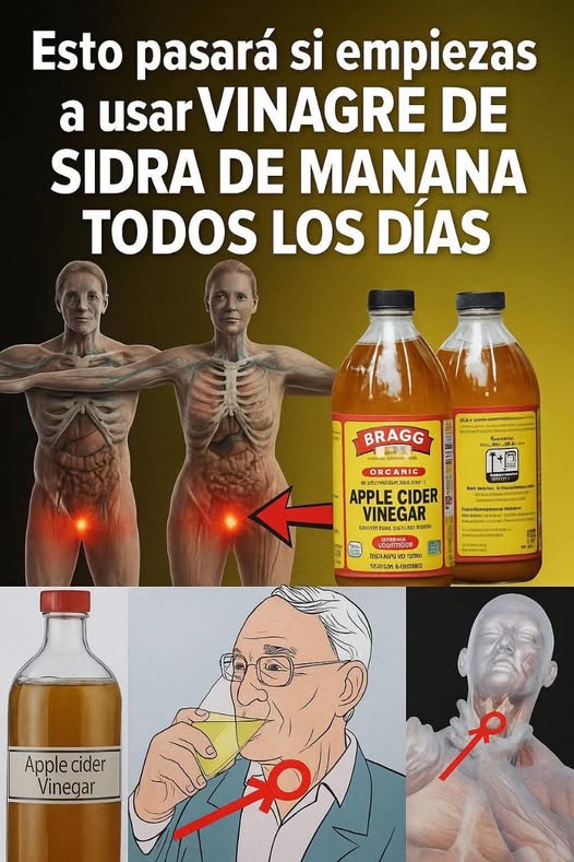 Beneficios del vinagre de sidra de manzana