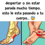 Dolor en el Talón: Comprendiendo la Fascitis Plantar y Remedios Naturales