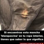¿Qué Significa la Mancha Blanquecina en tu Ropa Interior?