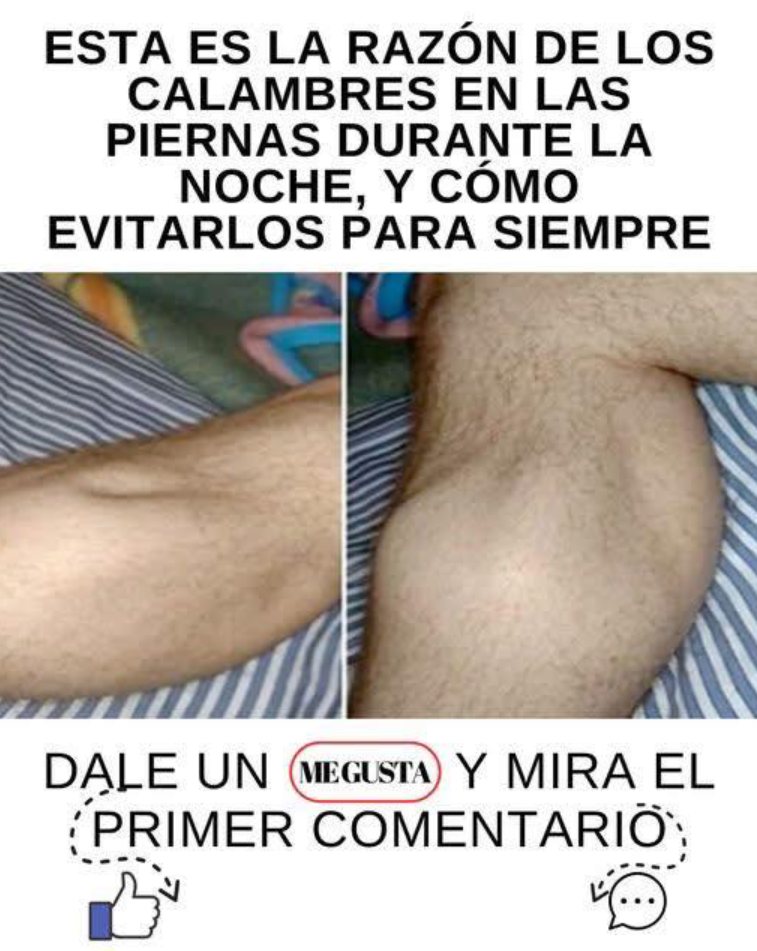 Calambres Musculares en las Piernas