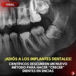 Revolución Odontológica: ¡Adiós a los Implantes Dentares!