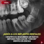 ¡Adiós a los Implantes Dentales! El Futuro de la Odontología: Crecimiento de Dientes en Encías