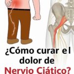 Adiós al Dolor del Nervio Ciático: Técnicas Naturales y Efectivas