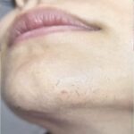 Cuidado del Vello Facial: Remedios Naturales para las Mujeres