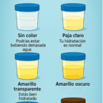 El Color de la Orina: Un Indicador de Salud y Hidratación