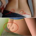 Hoyuelos de Venus: Comprendiendo su Significado y Salud