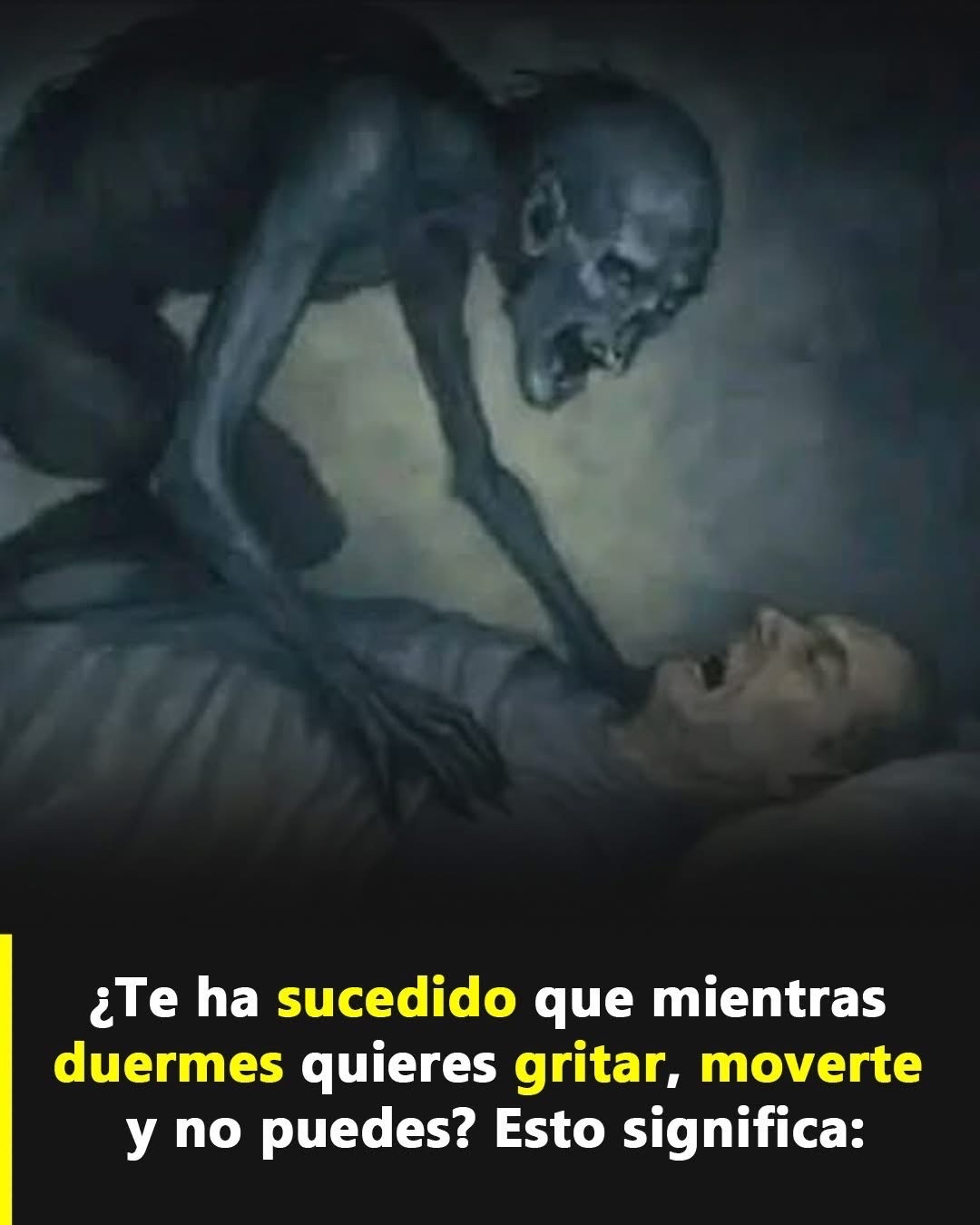 Episodio de parálisis del sueño