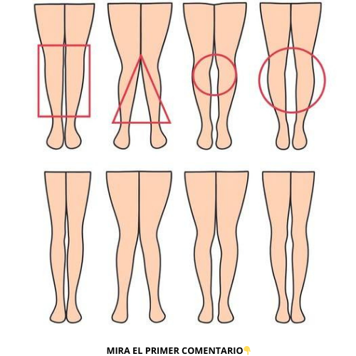 Diferentes tipos de piernas en figuras geométricas