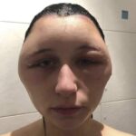 Cuidado al Usar Tintes para el Cabello: Consecuencias y Remedios Naturales