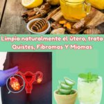 Limpia Naturalmente Tu Útero: Remedios para Quistes, Fibromas y Miomas