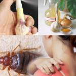 Elimina Chinches de Tus Sábanas con Estos Remedios Naturales Efectivos