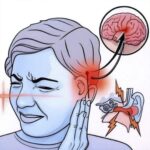 Zumbido en el Oído: ¿Qué Significa y Cómo Tratarlo de Forma Natural?