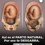 El Parto Natural: Expectativas vs Realidad y su Impacto Físico