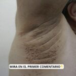 Descubre los Primeros Síntomas de Estrés: Remedios Naturales y Recetas para Mejorar Tu Bienestar