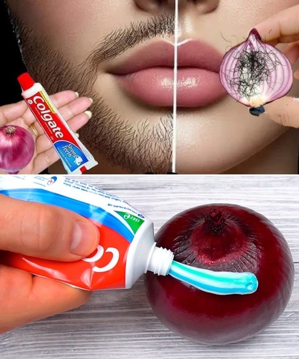 Remedio casero para vello facial con pasta de dientes y cebolla