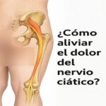 Alivio Natural para el Dolor del Nervio Ciático: Remedios y Hábitos Saludables