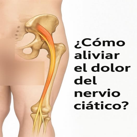 Ejercicio para aliviar el dolor ciático