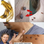 Elimina las Etiquetas de Piel en la Cara de Forma Natural