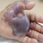 Consecuencias de Dormir con el Teléfono Móvil: Mejora tu Salud con Remedios Naturales