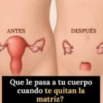 ¿Qué Sucede en Tu Cuerpo Después de una Histerectomía?