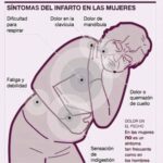Infarto en Mujeres: Síntomas Clave que Debes Conocer