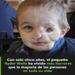 Beneficios de los Remedios Caseros: Guía Completa para una Salud Óptima