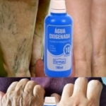 Elimina Manchas y Arrugas de Forma Natural con Agua Oxigenada