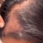 Receta Natural para Hacer Crecer el Cabello Rápido y Saludable