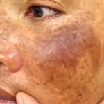 Transforma Tu Piel: Elimina Arrugas y Manchas con Esta Asombrosa Crema Natural