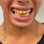 Blanquea tus Dientes de Forma Natural y Efectiva