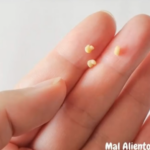 ¿Te Ha Salido Esto en la Boca y Huele Mal? Descubre las Causas y Remedios Naturales