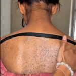 Exfoliante Natural: Tu Nuevo Aliado para una Piel Radiante
