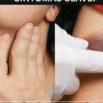 Leucemia: Señales Silenciosas y Cómo Mantener la Salud