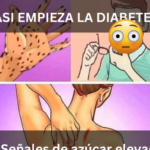 7 Señales que Indican que Tienes Azúcar Alta en la Sangre