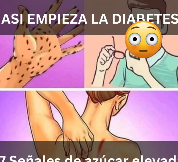 Señales de azúcar alta en la sangre