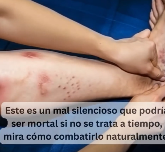 Prevención de Trombosis