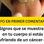 Cáncer de Estómago: Una Enfermedad Silenciosa y sus Primeros Síntomas